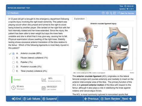 is the pance test hard|how long for the pance exam.